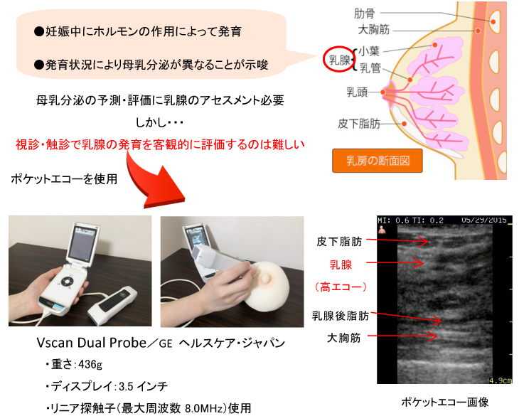 母乳分泌の予測・評価に乳腺のアセスメント必要,しかし‥視診・触診で乳腺の発育を客観的に評価するのは難しい,ポケットエコーを使用